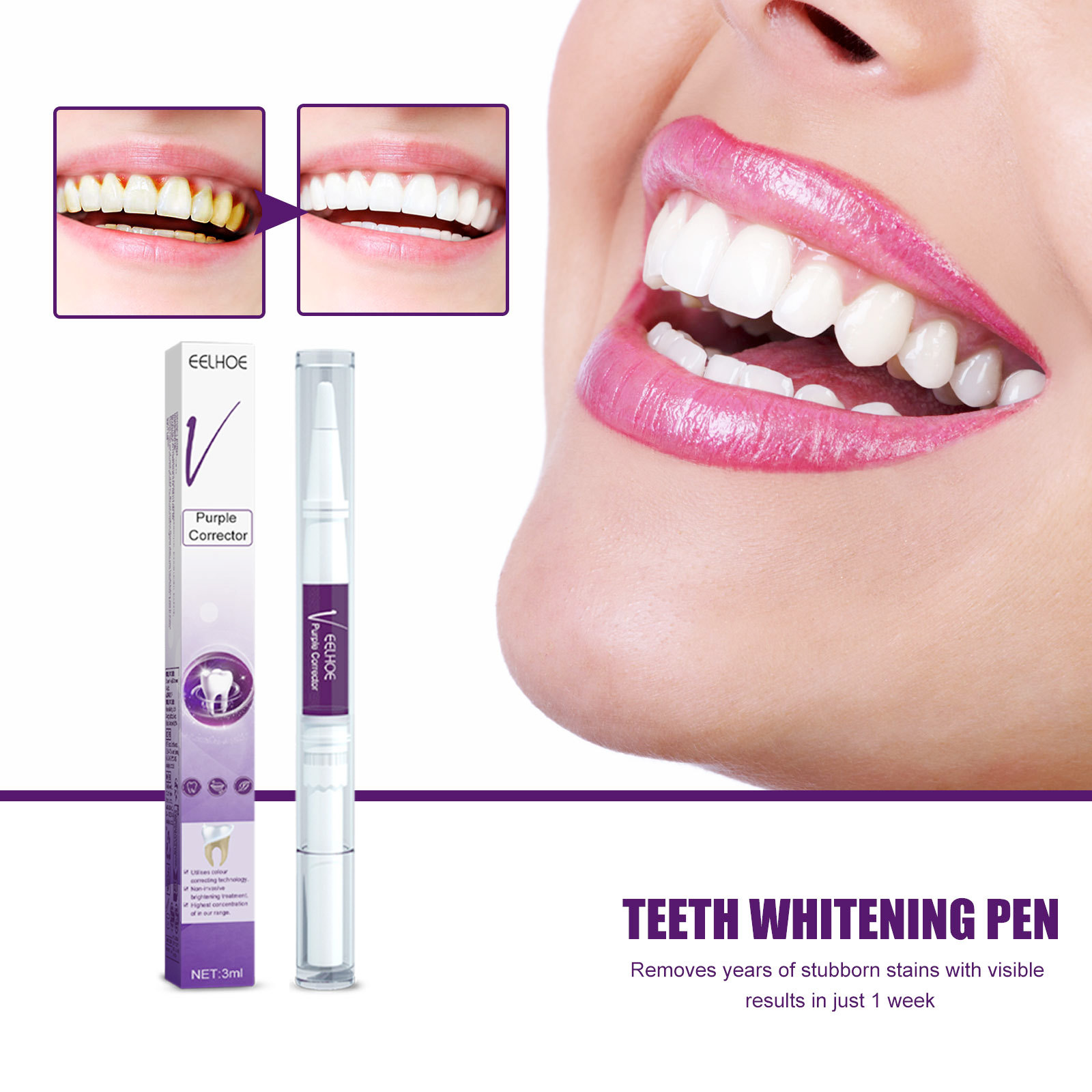 Whitening Pen Bleach - Purple Teeth Whtening Toothpaste Pen Remove