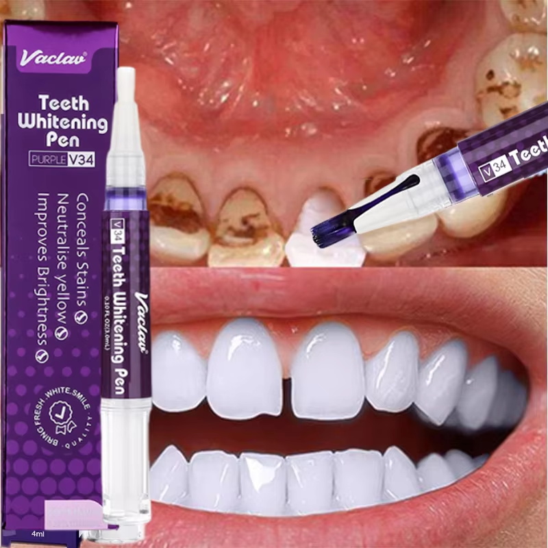 Whitening Pen Bleach - V34 Teeth Whtening Pen Toothpaste Remove