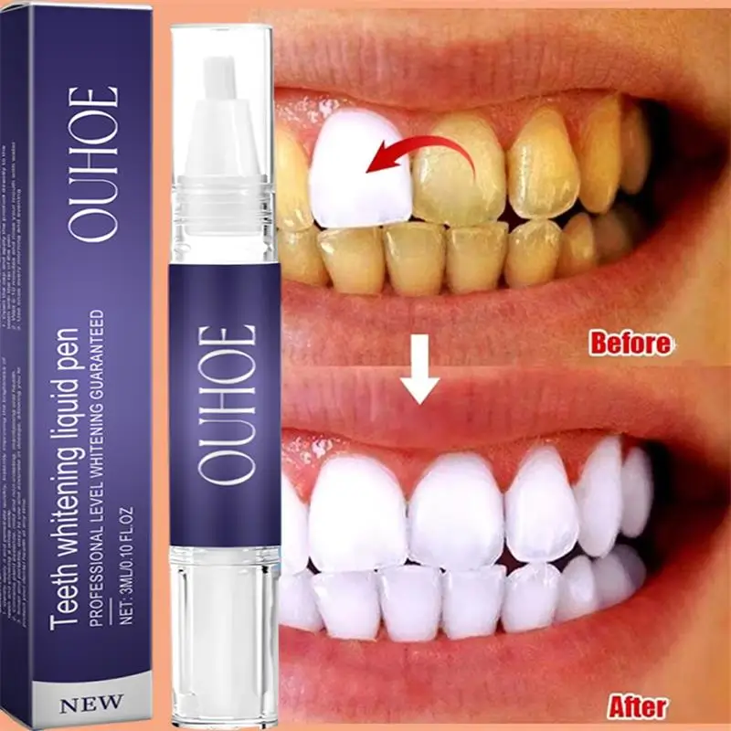 Whitening Pen Bleach - Fast Teeth Whtening Toothpaste Pen Remove