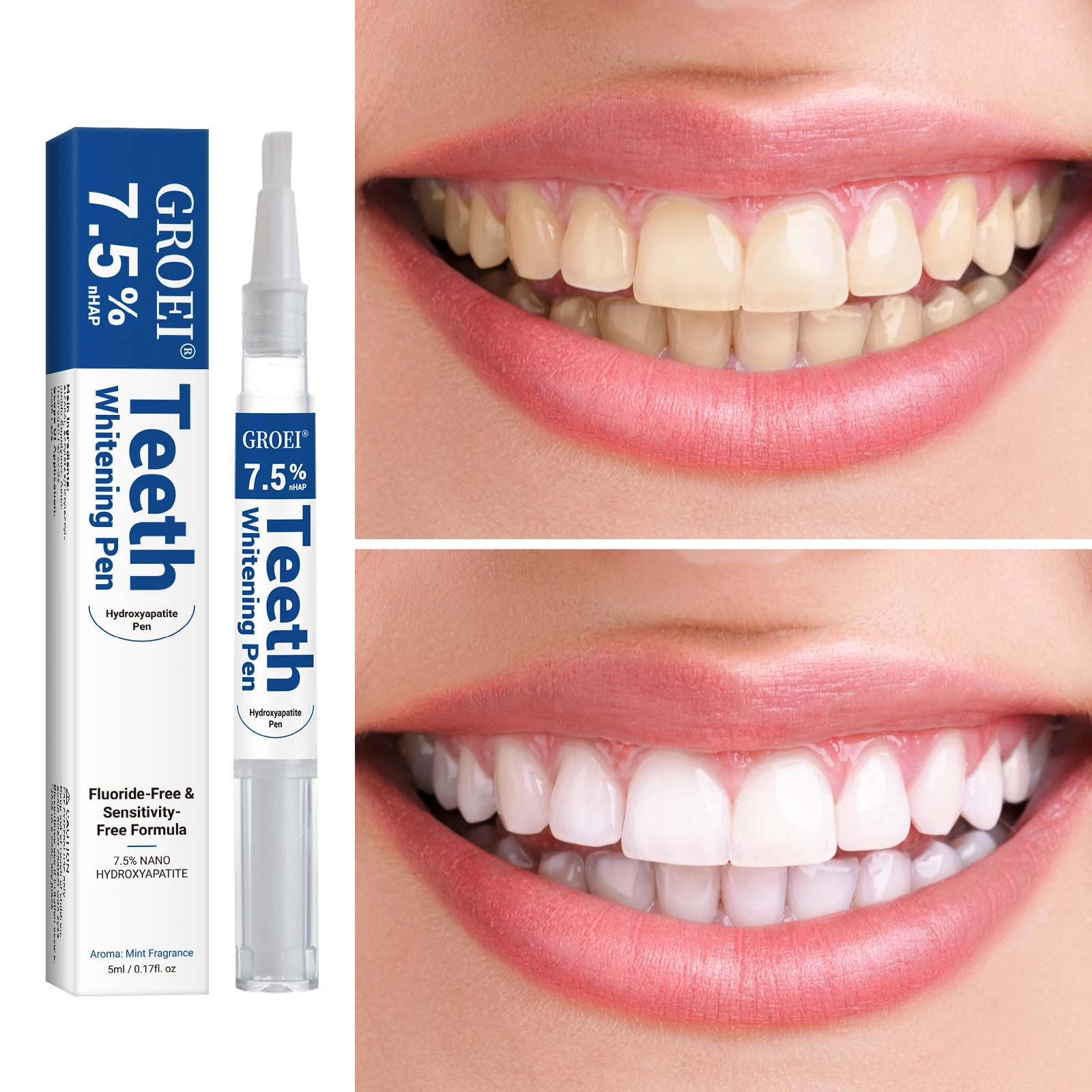Hydroxyapatite Tooth Whitening - Teeth Whitening Session recension och pris