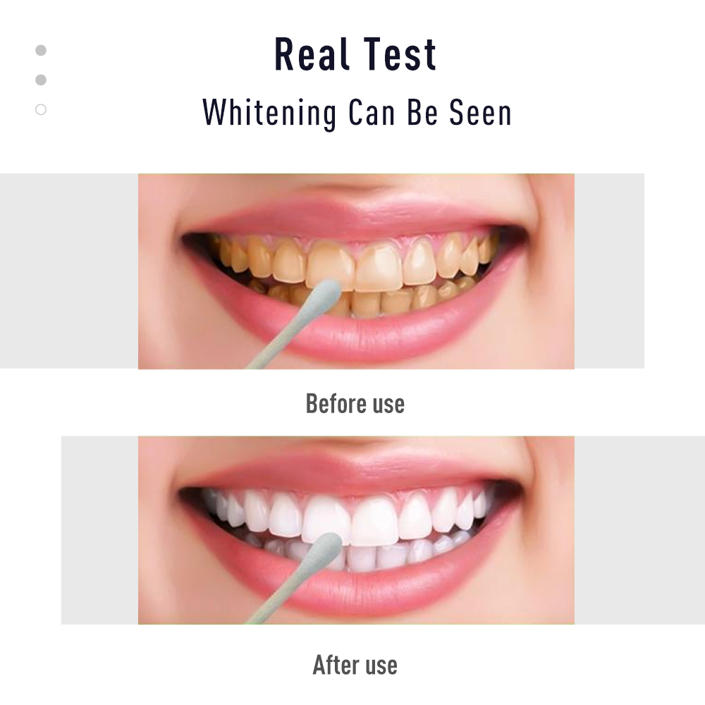 Pen Tooth Gel White  Kit Clean - Whitening Pen Bleach recension och pris