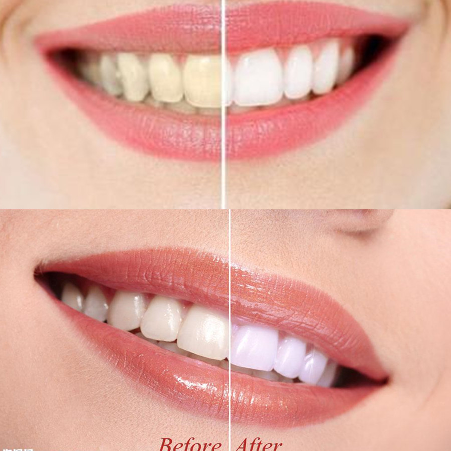 Bamboo Charcoal Teeth Tooth De - Teeth Whitening Charcoal recension och pris