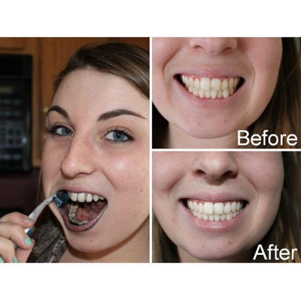 Bamboo Charcoal Teeth Tooth De - Teeth Whitening Charcoal recension och pris