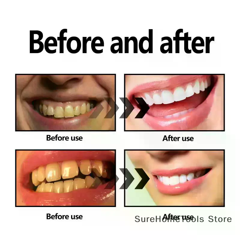 Bamboo Charcoal Powder For Tee - Teeth Whitening Charcoal recension och pris