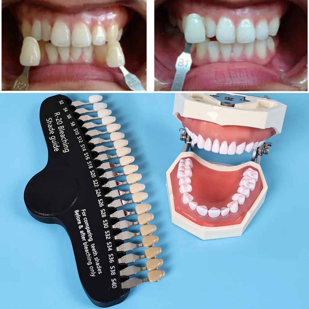 ELIJAH R-20 Bleaching Shade Gu - Teeth Whitening Shade Guide recension och pris