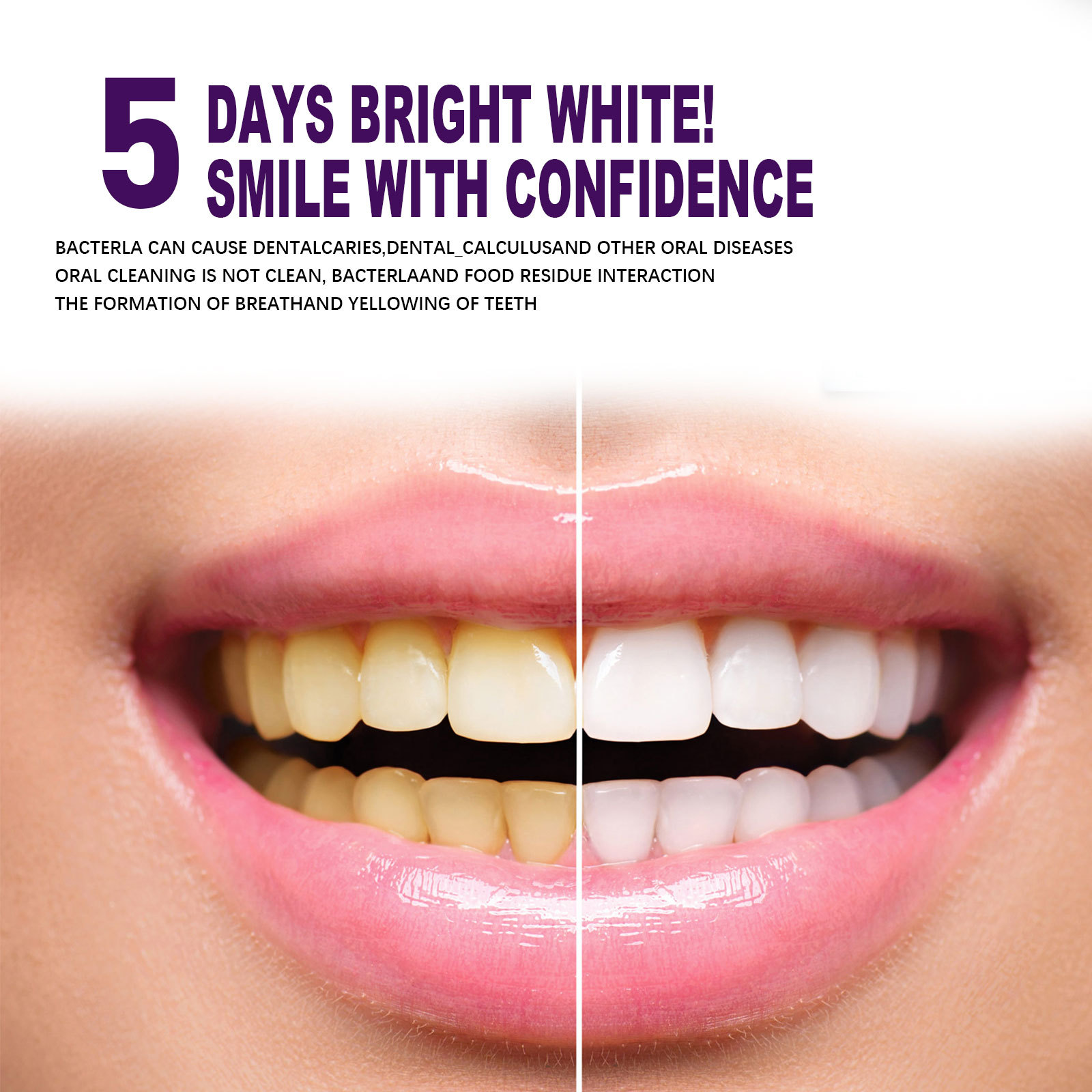 Purple Teeth Whtening Toothpas - Whitening Pen Bleach recension och pris