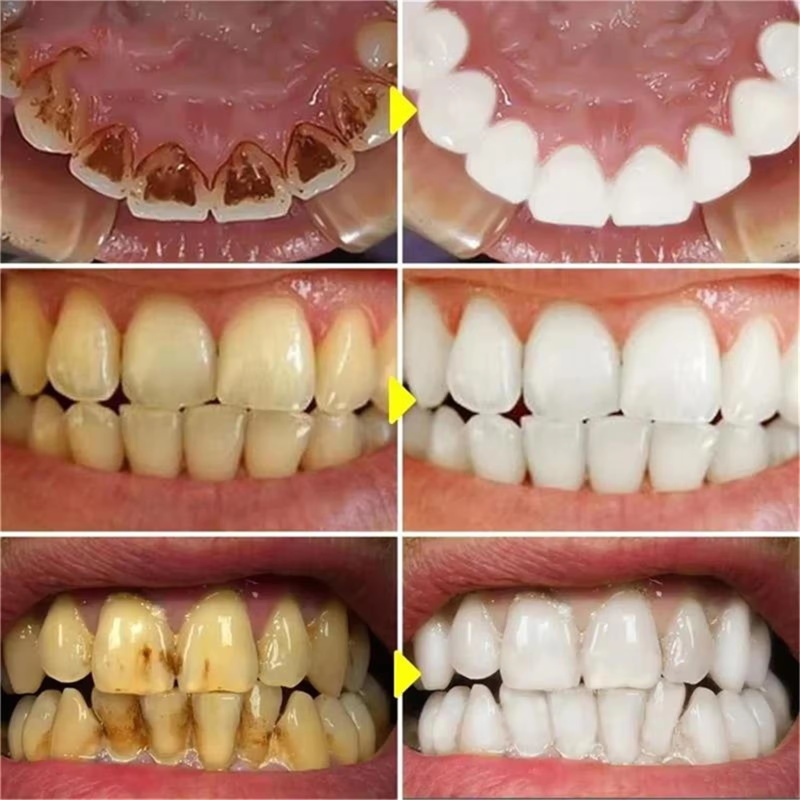 V34 Teeth Whtening Pen Toothpa - Whitening Pen Bleach recension och pris