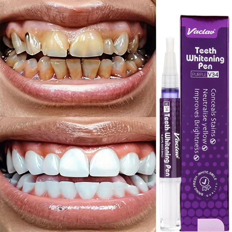 V34 Teeth Whtening Pen Toothpa - Whitening Pen Bleach recension och pris