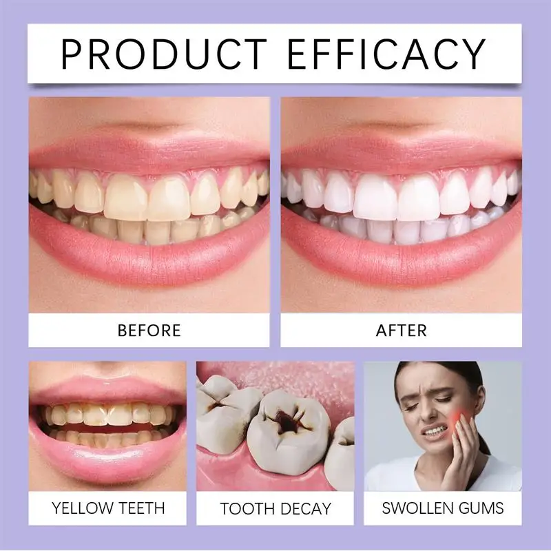 Fast Teeth Whtening Toothpaste - Whitening Pen Bleach recension och pris